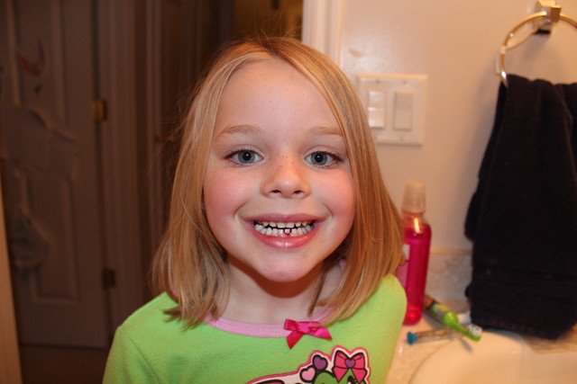 Sarah about to lose her first tooth