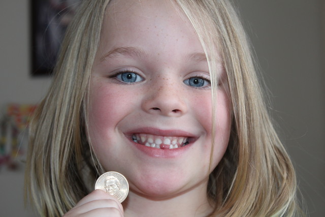 Sarah showing off her tooth hole (and the moo-lah)!