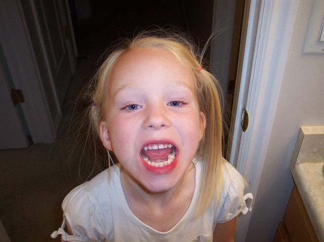 Emma about to have her loose tooth pulled