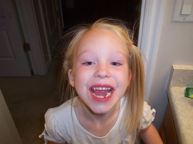 Emma after her tooth was out